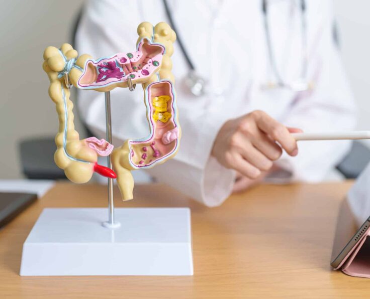 Doctor with human Colon anatomy model and tablet. Colonic disease, Large Intestine, Colorectal cancer, Ulcerative colitis, Diverticulitis, Irritable bowel syndrome and Digestive system